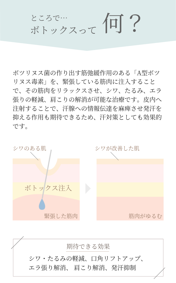 ボトックスとは